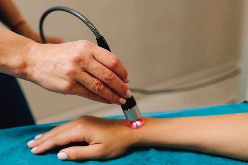 laser physiotherap